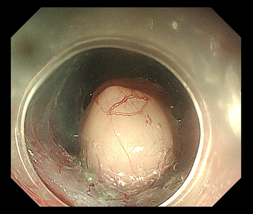 图片-5.jpg 图片-5.jpg