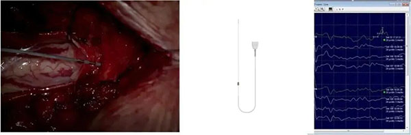 DM_20260407093028_003.jpg DM_20260407093028_003.jpg