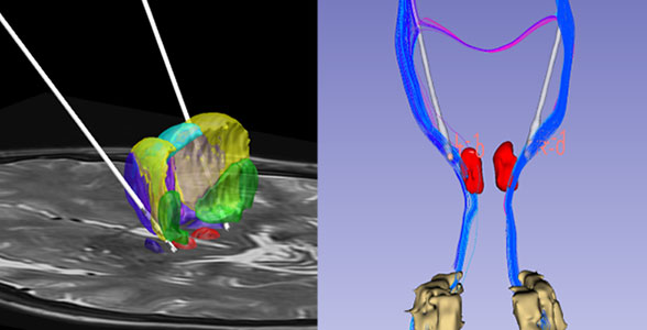 进修招生|宣武医院功能神经外科中心2026年春季进修招生工作已开启