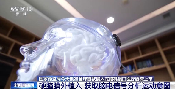 科室新闻｜全球首款 中国脑机接口医疗器械正式获批上市